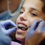 6 Signs You Might Need Orthodontic Treatment